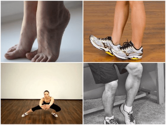 krčne žile povzročajo bolečine v nogah