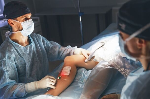 operacija krčnih žil z laserjem