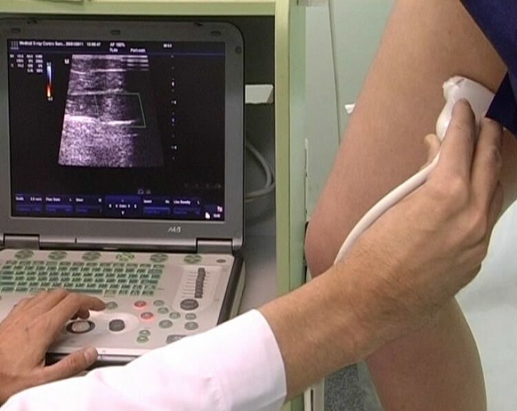 ultrazvočna diagnostika krčnih žil medenice