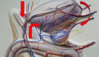 krčne žile medenice