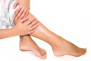 Simptomi krčnih žil na nogah pri ženskah